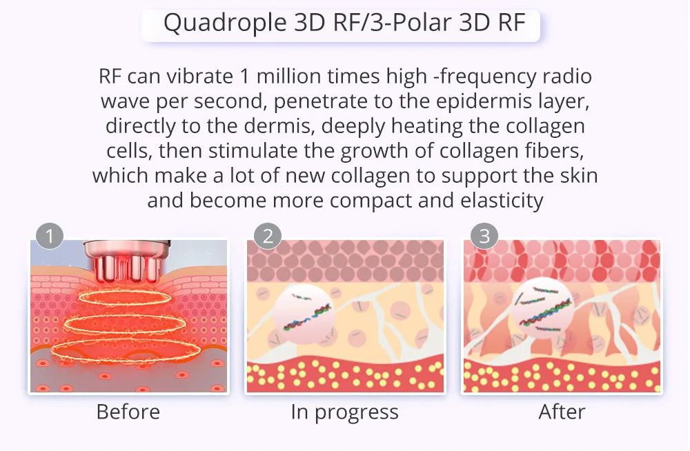 High-tech cavitation machine stimulates collagen growth and improves skin elasticity for a younger look.