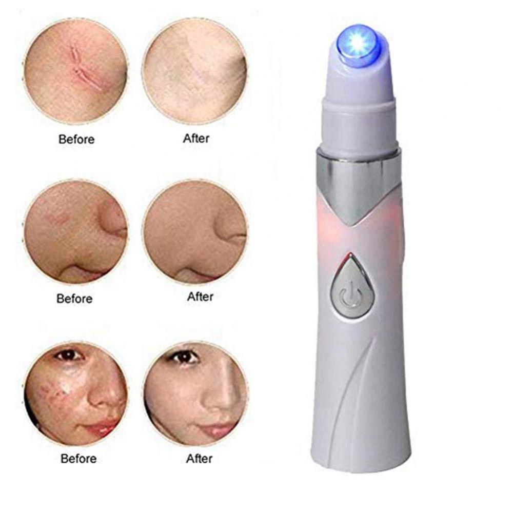 Rechargeable Ultrasonic Face Skin Scrubber Facial Cleaner Peeling Vibration Exfoliating Pore Blackhead Acne Removal Pen Tools