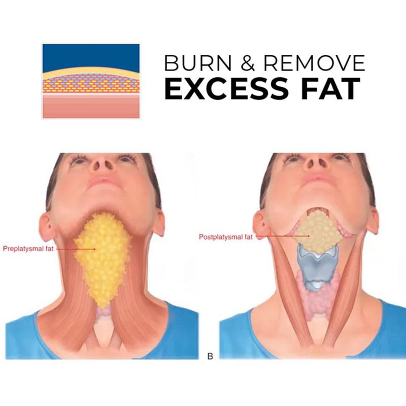 BURN & REMOVE EXCESS FAT