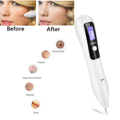 Mini Micro Current Electronic Pen Professional Cleaning Warts Spot Black Spot Skin Label Mole Tattoo Freckle Removal Beauty Care