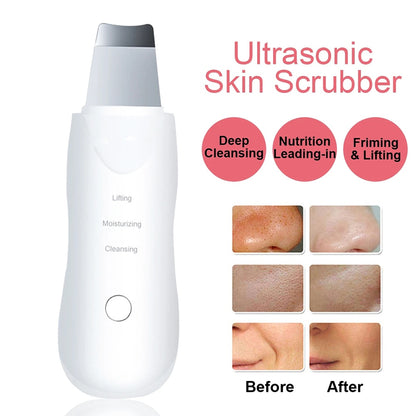 Esfregador de pele ultrassônico, máquina de limpeza facial profunda, pá, peeling, limpador facial de poros, máquina de levantamento de pele facial