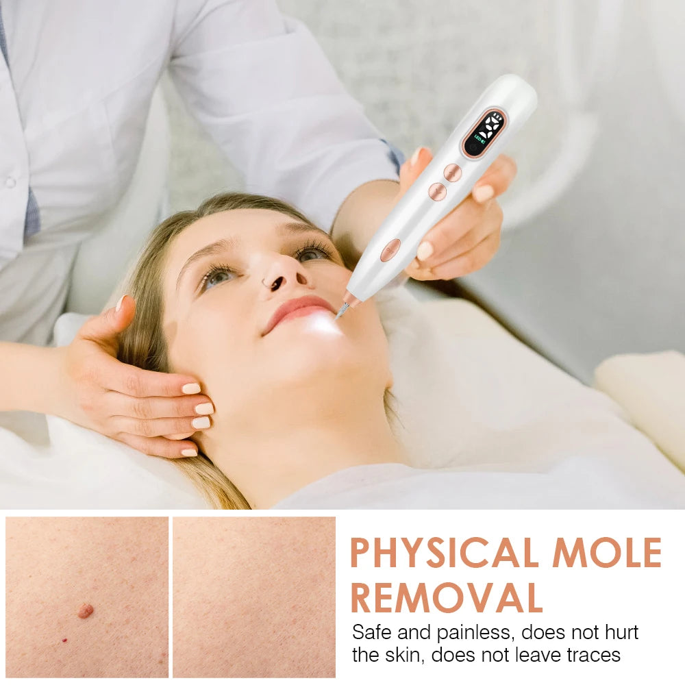 Safe and Painless Mole Removal: No Skin Discomfort or Scars.