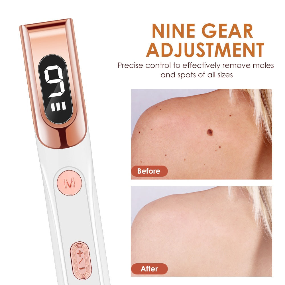 NINE GEAR ADJUSTMENT Effectively remove moles and