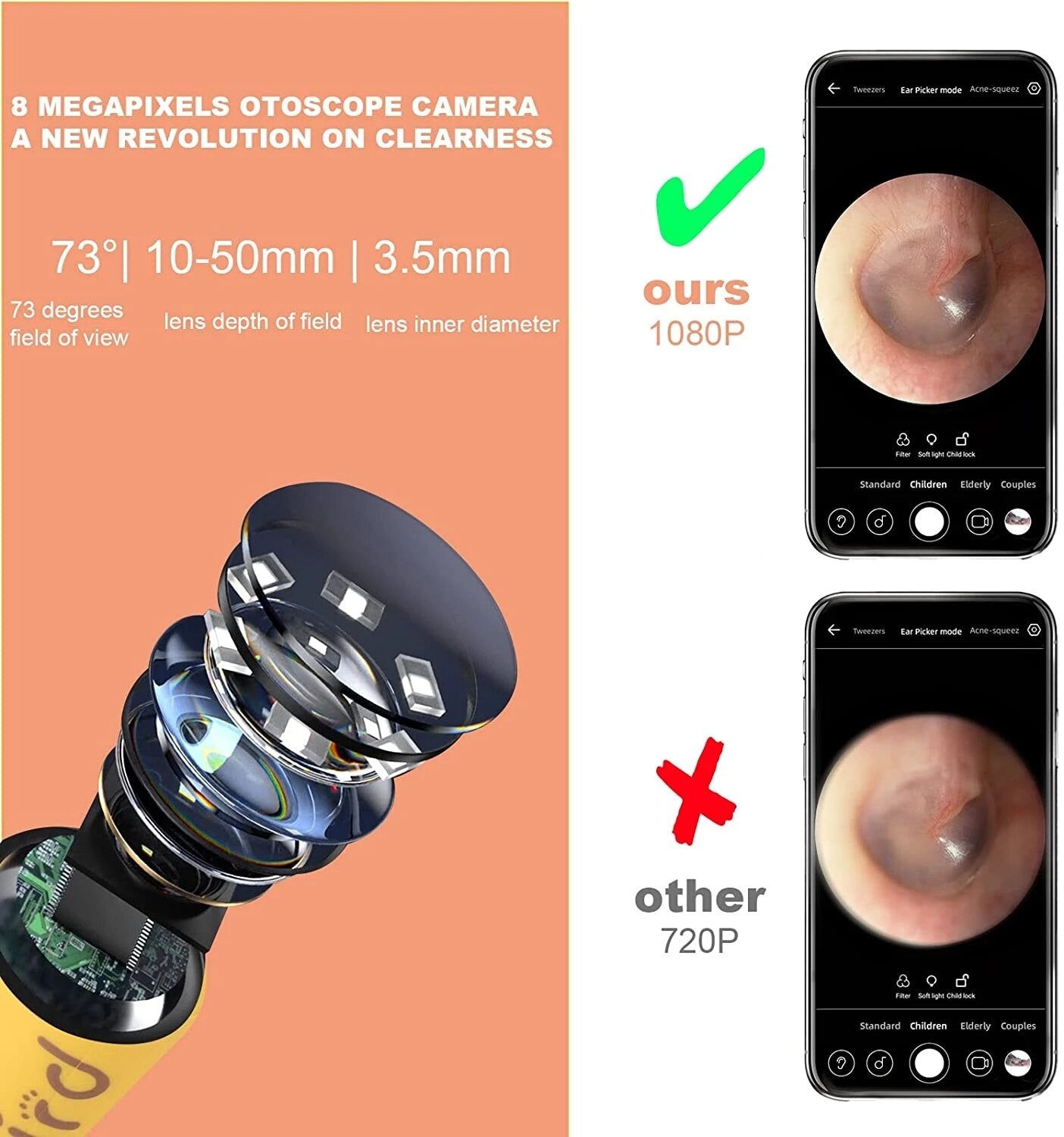 8 MEGAPIXELS OTOSCOPE CAMERA