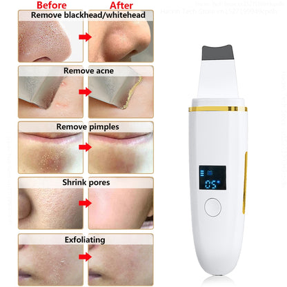 Eliminador de depurador de piel ultrasónico Espinilla Peeling ultrasónico Limpiador facial Pala Limpieza profunda Estiramiento facial Eliminar acné de poros