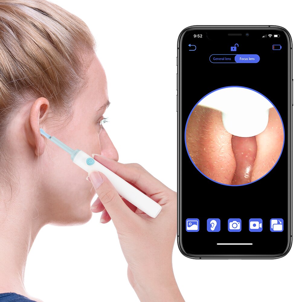 Smart Electric Ear Otoscope Visual Ear Sticks Limpeza sem fio 3,9mm 1080P Endoscópio Wifi Otoscope 6 LED Light Ear Care Tool