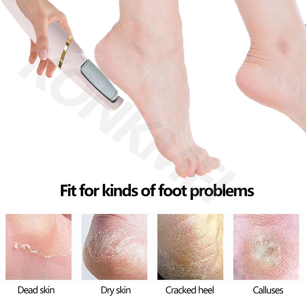 New Foot File Callus Remover Professional Electric Pedicure Tools Skin Care for Heels Grinding Beauty Health Dead Skin Remover