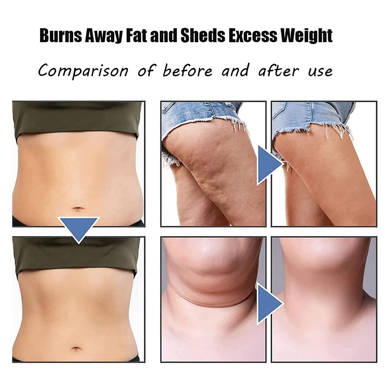 Burns Away Fat and Sheds Excess Weight Comparison