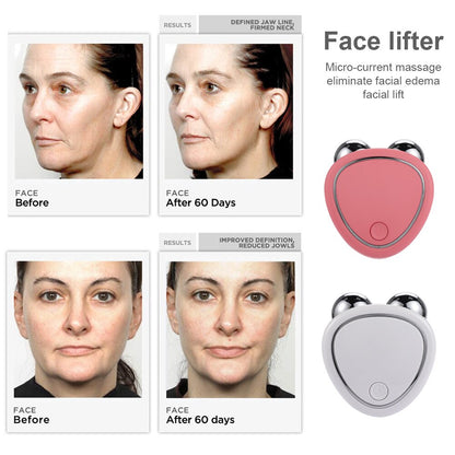 RESULTS DEFINERMEV NECR Face lift