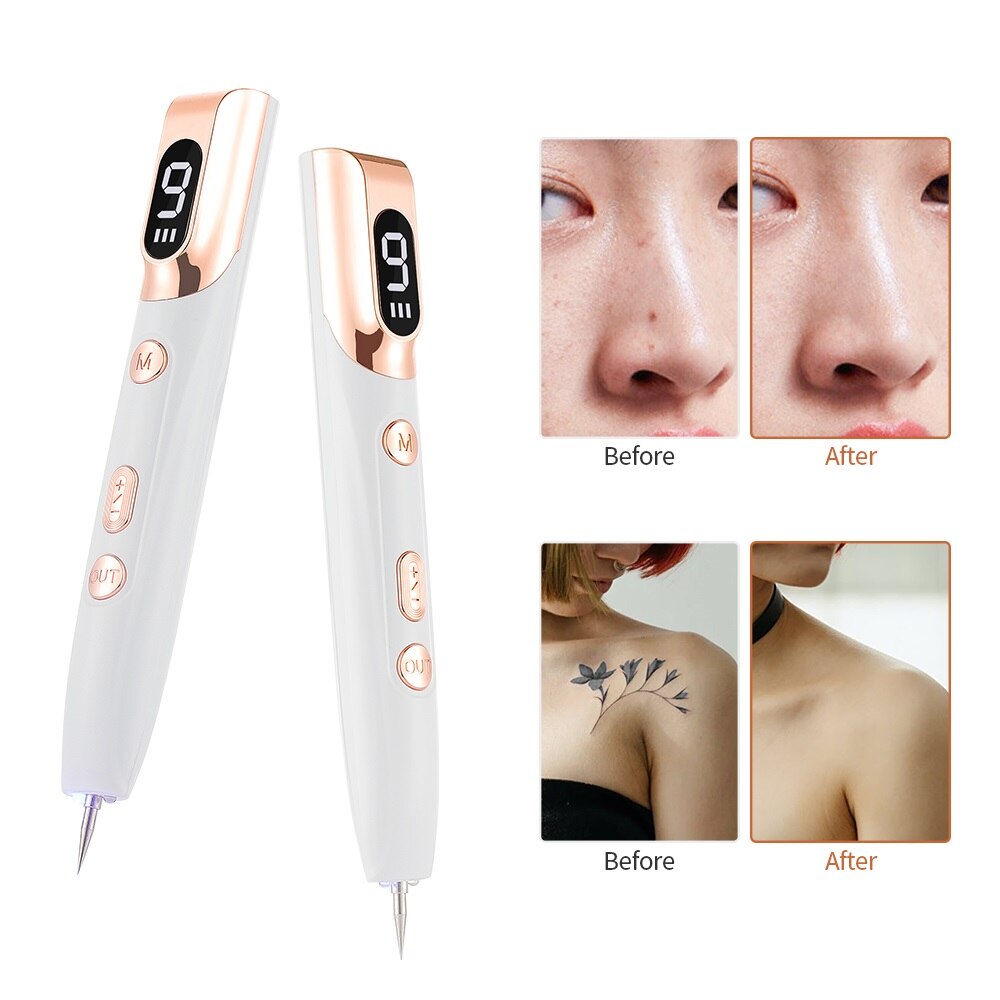 Stylo professionnel pour enlever les taupes de rousseur, stylo dissolvant de cicatrices de tatouage, nettoyeur de taches de verrues, décoloration des marques d'acné, soins de la peau, Machine de beauté