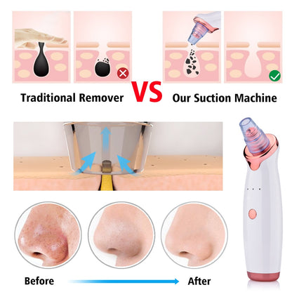 Traditional Remover VS Our Suction Machine Before