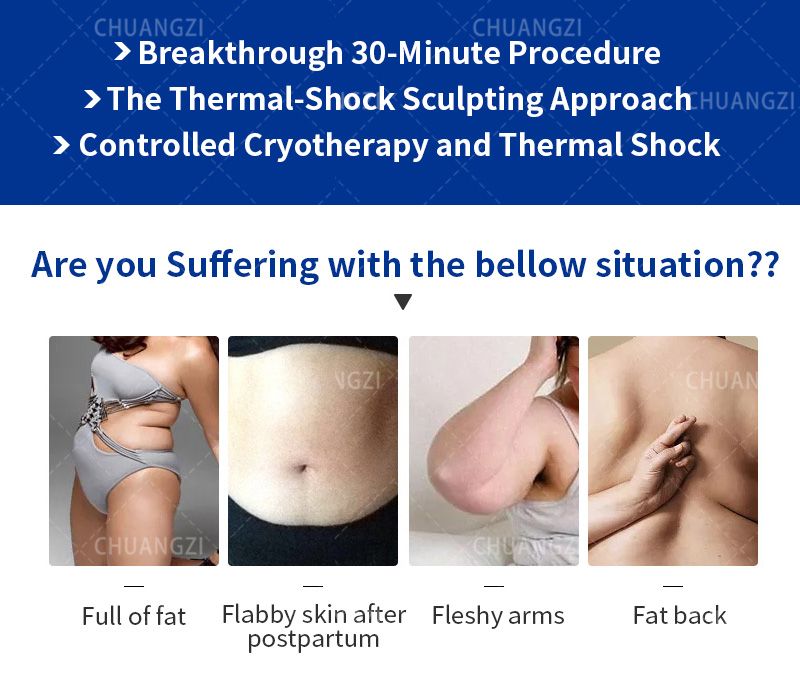 Cryotherapy machine, Chuangzi, treats stubborn fat and flabby skin after childbirth or postpartum in just 30 minutes.