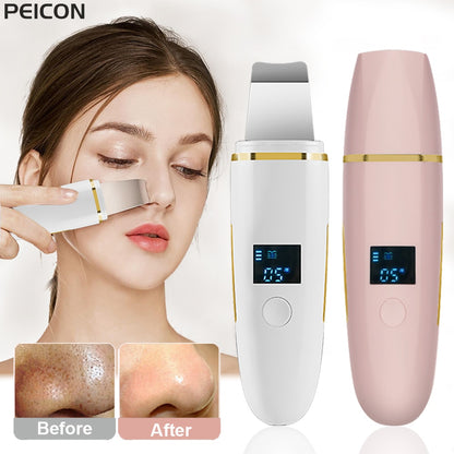 Ultrasonic Skin Scrubber Facial Peeling Removedor de cravos Limpeza profunda do rosto Espátula de poros Limpeza ultrassônica do rosto Skin Scrubber