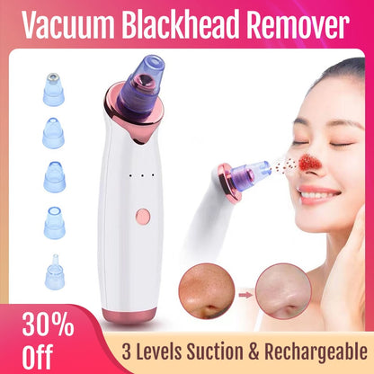 Vacuum Blackhead Remover Face Black Spots Cleaner White Dot Pimple Removal Tools 2022  New Arrival